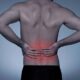 How to Get Rid of Cauda Equina Syndrome